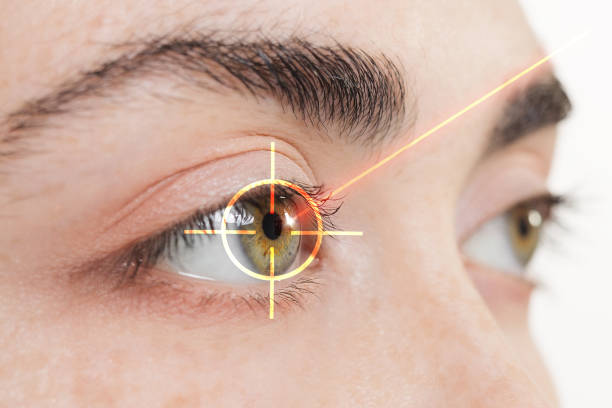 Essential things to know if you’re considering Lasik eye surgery